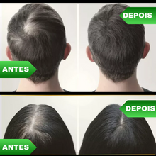 Upload image to gallery viewer, Tônico Capilar 7 Days® - NutriCresce
